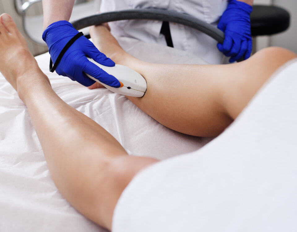 Quanto custam as varizes? Do ambulatório ao pós-tratamento